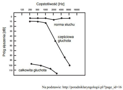 Wyniki badania pacjentów z częściową głuchotą.