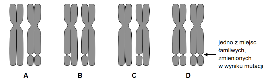 Zespół łamliwego chromosomu X